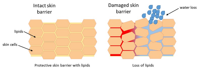 Graphic showing intact skin barrier and damaged skin barrier